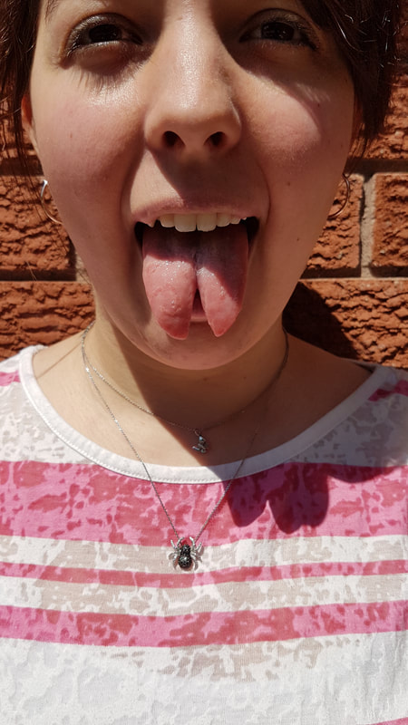 Tongue Bifurcation, Tongue Splitting, Tongue Split, Body Modification, Ottawa Ontario.
